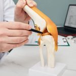 Meniscus Tears: Anatomy, Biomechanics, and Modern Treatment Approaches
