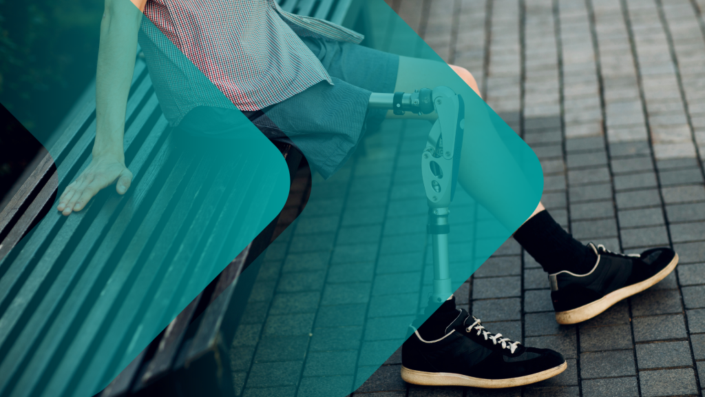 Prosthetic Considerations for the Injured Worker