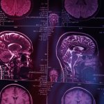 How Functional Neurology Supports Traumatic Brain Injury Rehabilitation