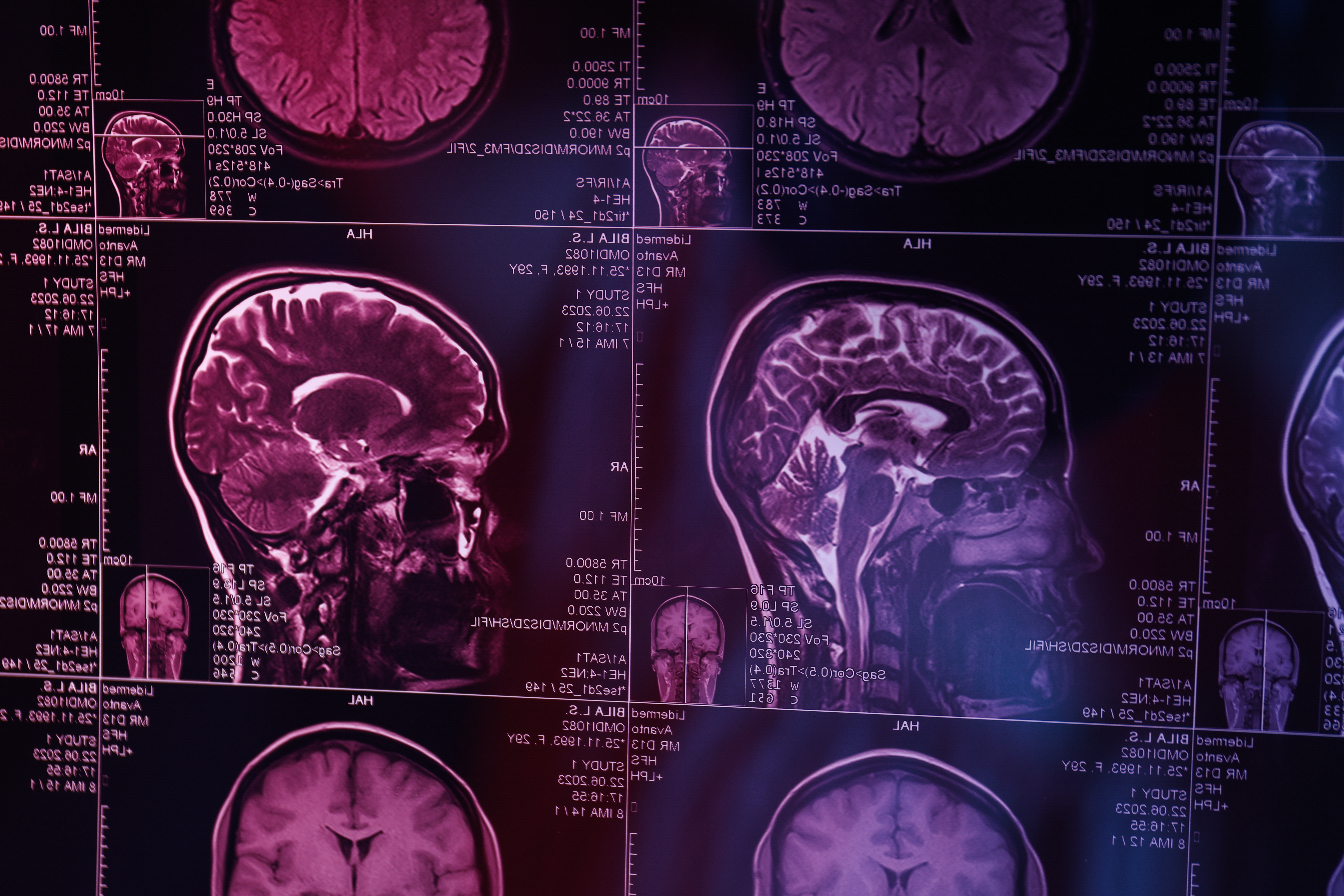 How Functional Neurology Supports Traumatic Brain Injury Rehabilitation