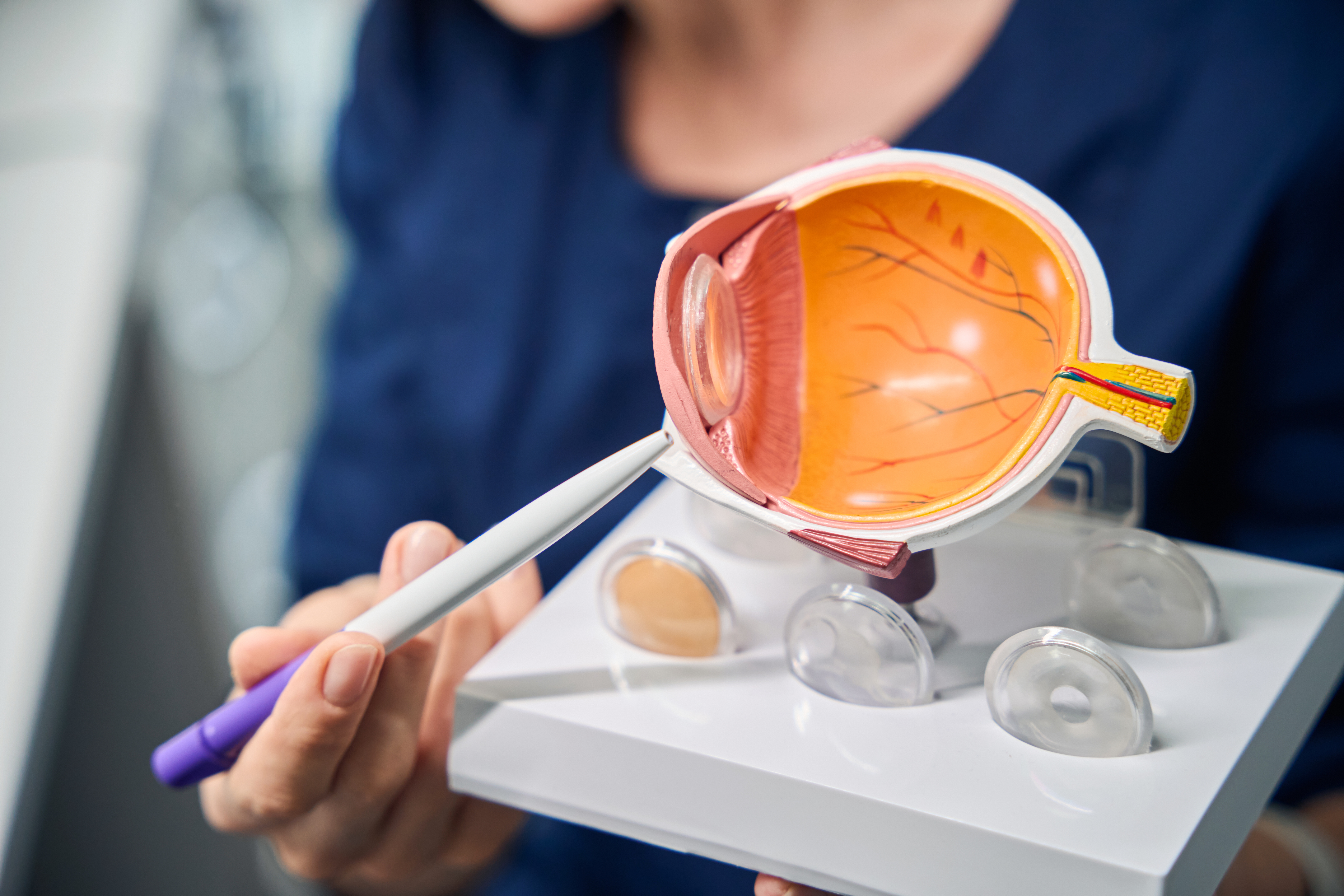 Eye model demonstration in female doctors hand