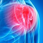 Shoulder Labral Tears and Biceps Tears: Diagnosis, Treatment, and Return-to-Work Strategies