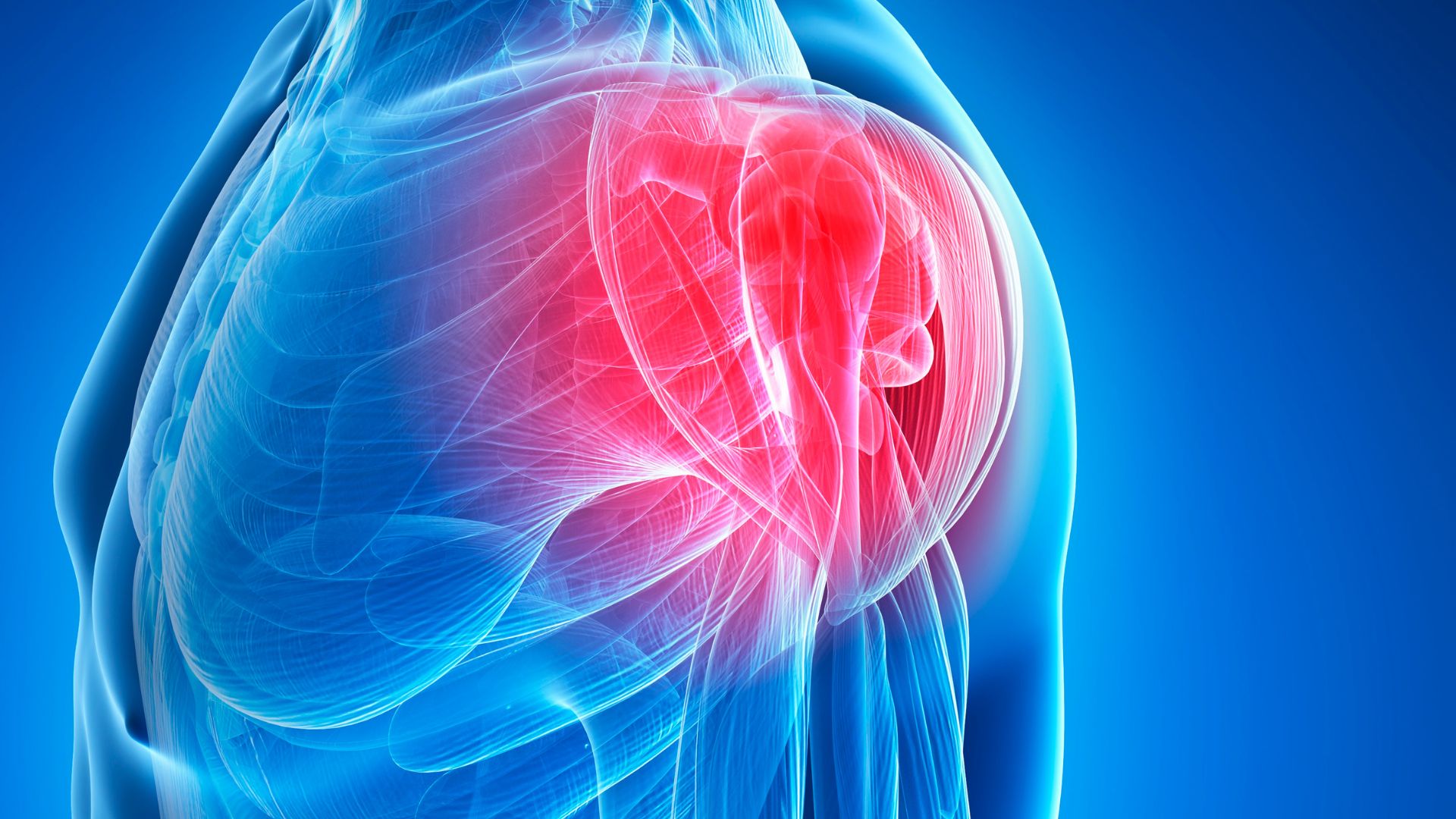 Shoulder Labral Tears and Biceps Tears: Diagnosis, Treatment, and Return-to-Work Strategies
