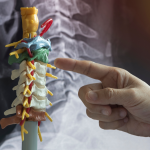 The Evolution of Spine Surgery: How Robotic-Assisted Innovation Is Improving Recovery for Injured Workers